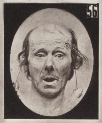 L0040105 Experiments in physiology. Facial expressions; Surprise Credit: Wellcome Library, London. Wellcome Images images@wellcome.ac.uk http://wellcomeimages.org The facial expression of surprise on the human face being induced by electrical currents. Photograph 19th Century By: Guillaume Benjamin Amand Duchenne de BoulogneMécanisme de la physionomie humaine, ou, Analyse électro-physiologique de l'expression des passions Guillaume Benjamin Amand Duchenne de Boulogne Published: 1862 Copyrighted work available under Creative Commons by-nc 2.0 UK, see http://wellcomeimages.org/indexplus/page/Prices.html