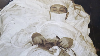 “Πονάει σαν να με τρυπάει ο διάβολος!” Ο Σοβιετικός γιατρός που έκανε στον εαυτό του εγχείρηση σκωληκοειδίτιδας