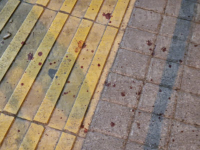 Πυροβόλησαν 25χρονο στη Θεσσαλονίκη. Οι δράστες μάζεψαν τους κάλυκες και εξαφανίστηκαν