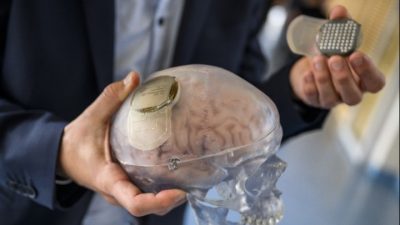 Η start-up Neuralink του Μασκ θα δοκιμάσει εγκεφαλικά εμφυτεύματα σε παράλυτους. Πώς θα λειτουργούν τα μικροτσιπ