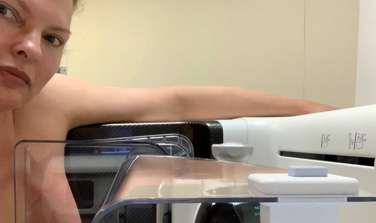 Γιατί η Λίντα Εβαντζελίστα ανέβασε φωτογραφία από τη μαστογραφία που έκανε όταν διαγνώστηκε με καρκίνο την πρώτη φορά