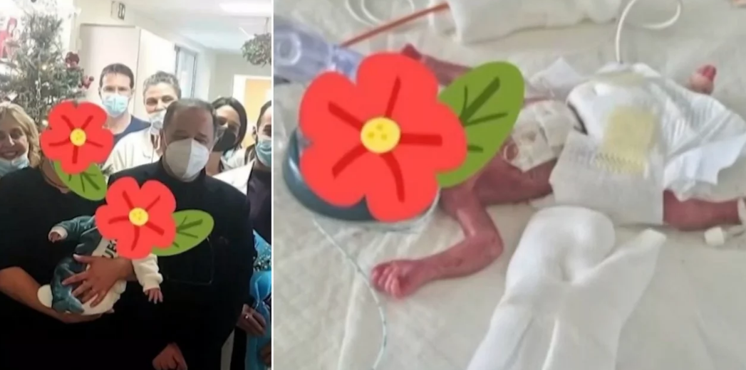 Nοσοκομείο Ρίου. Μωρό που γεννήθηκε 600 γραμ στις 23 εβδομάδες βγήκε από τη θερμοκοιτίδα μετά από 159 ημέρες (βίντεο)